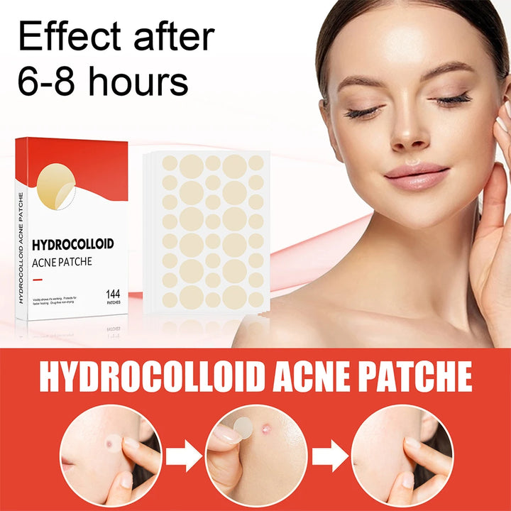 Hydrocolloid Pimple Patches | Acne Pimple Patch | Glamoursh
